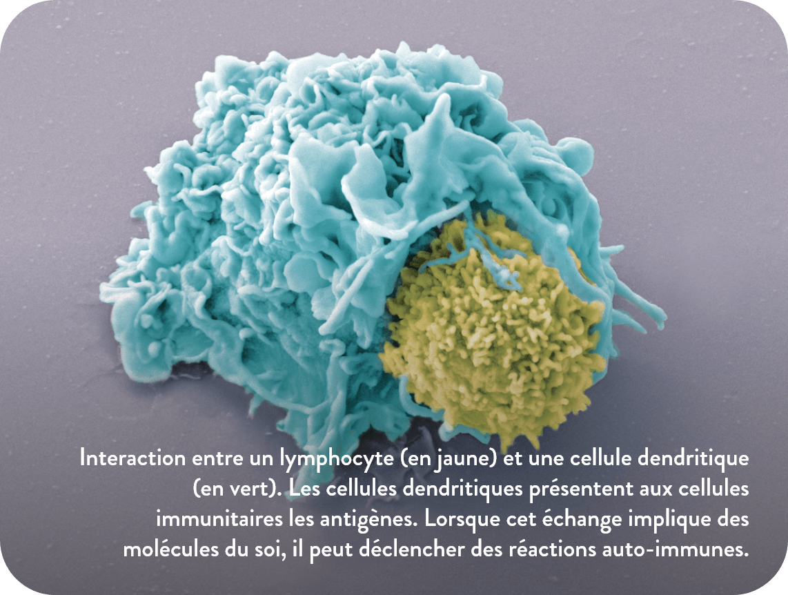 Interaction entre un lymphocyte (en jaune) et une cellule dendritique (en vert). Les cellules dendritiques présentent aux cellules immunitaires les antigènes. Lorsque cet échange implique des molécules du soit, il peut déclencher des réactions auto immunes.