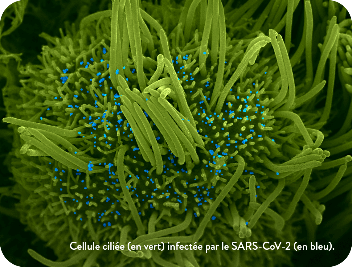 Cellule ciliée (en vert) infectée par le SARS-CoV-2 (en bleu).