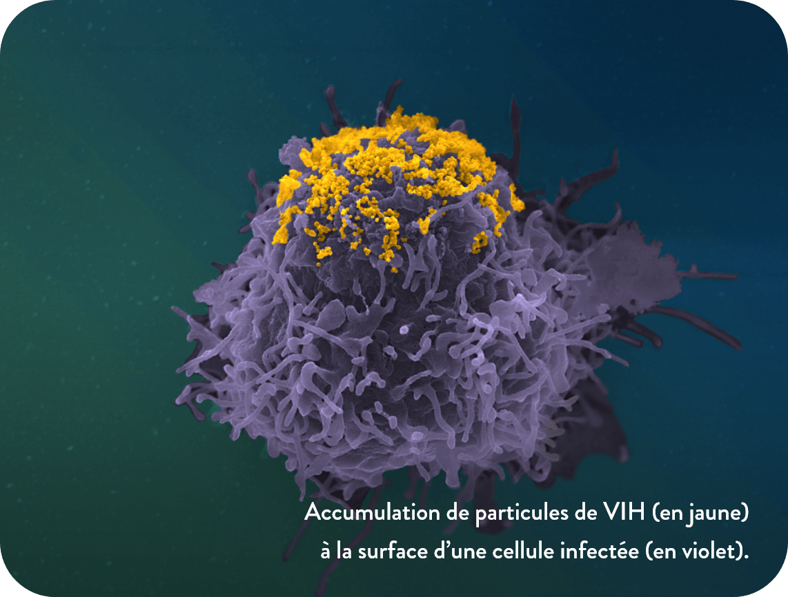Accumulation de particules de VIH (en jaune) à la surface d’une cellule infectée (en violet).