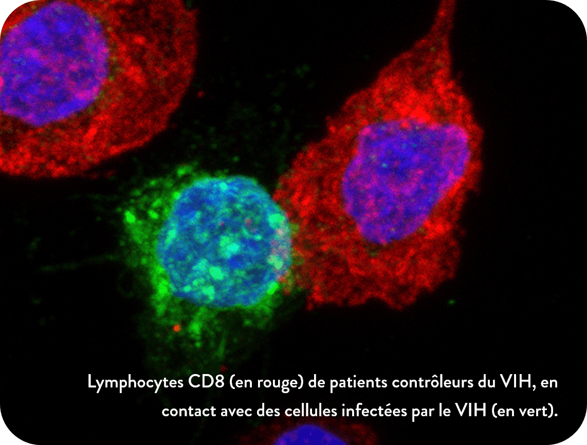 Lymphocytes CD8 (en rouge) de patients contrôleurs du VIH, en contact avec des cellules infectées par le VIH (en vert).