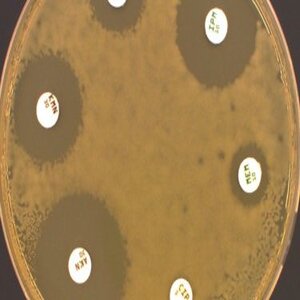 Par un mécanisme de défense, la bactérie Escherichia Coli fixe la résistance à un antibiotique