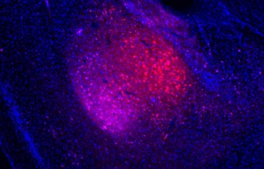 Dépression : un dysfonctionnement de certains neurones de l’amygdale serait la cause...