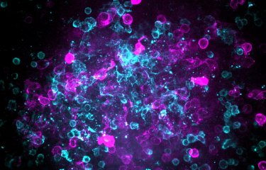 Evaluer l’efficacité des rappels vaccinaux grâce à des organes lymphoïdes artificiels sur puce ?