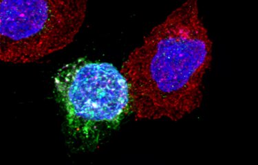 Lutte contre le VIH : les statines peuvent stimuler l’immunité antivirale