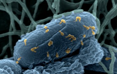 Les bactéries utilisent les mêmes outils pour résister aux antibiotiques et aux virus