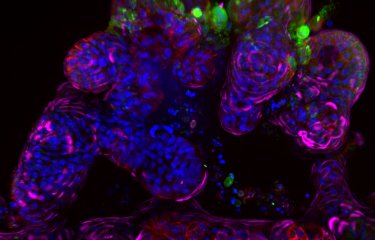Covid-19 : une nouvelle stratégie à l’étude pour lutter contre tous les variants
